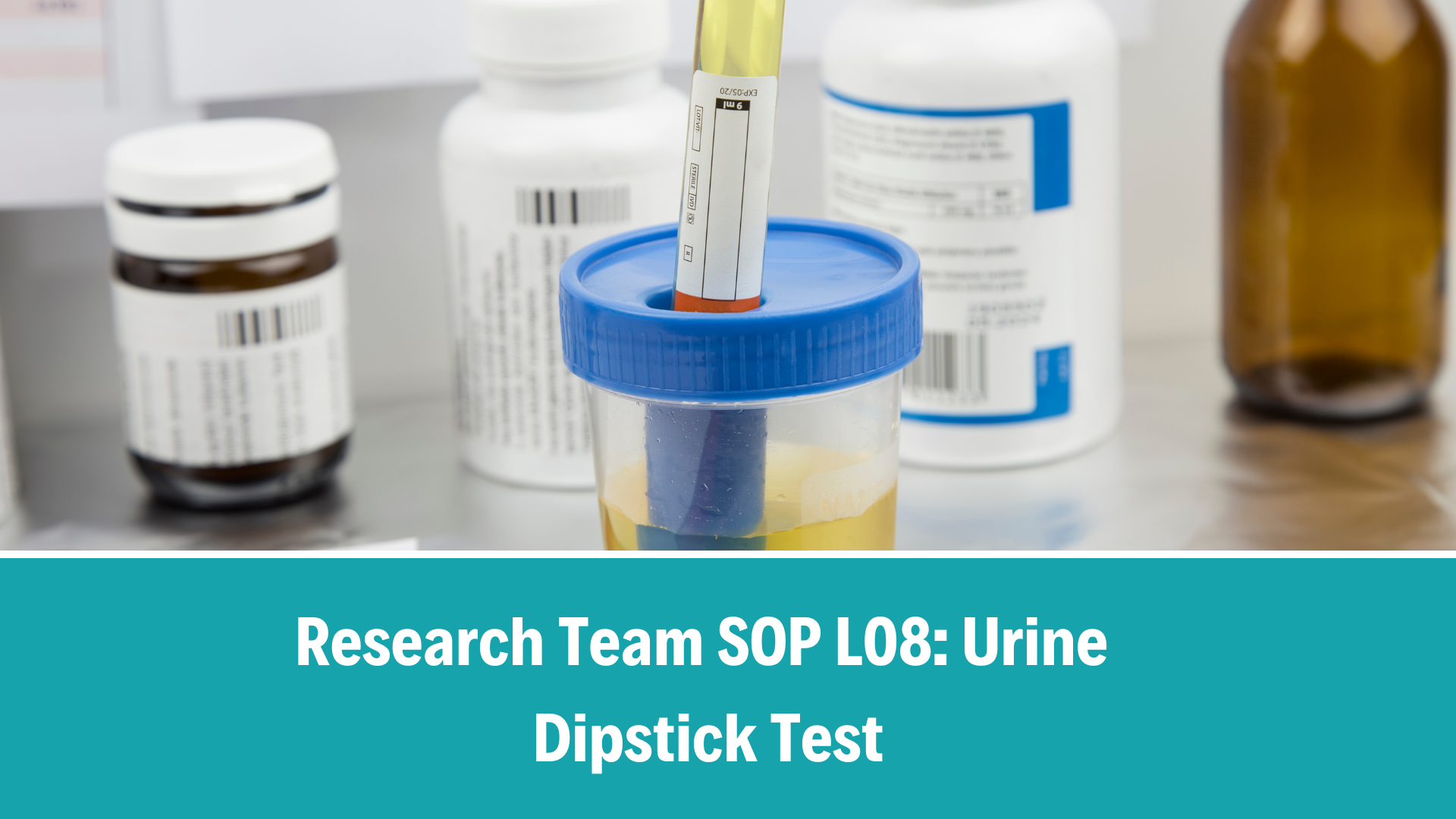 Research Team SOP L08: Urine Dipstick Test, V5.0, 17 Oct 2025