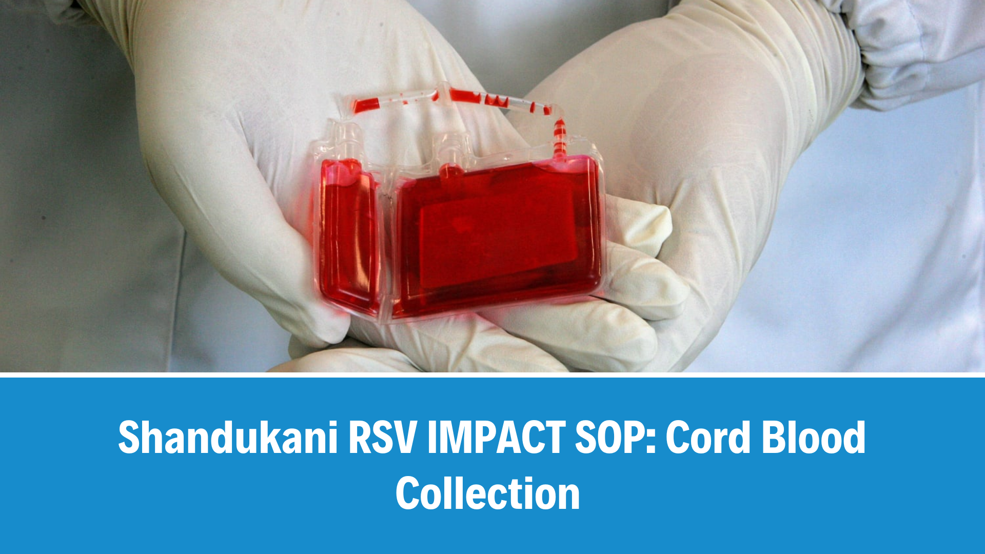  RSV IMPACT SOP: Cord Blood Collection, V2.0, 8 May 2026