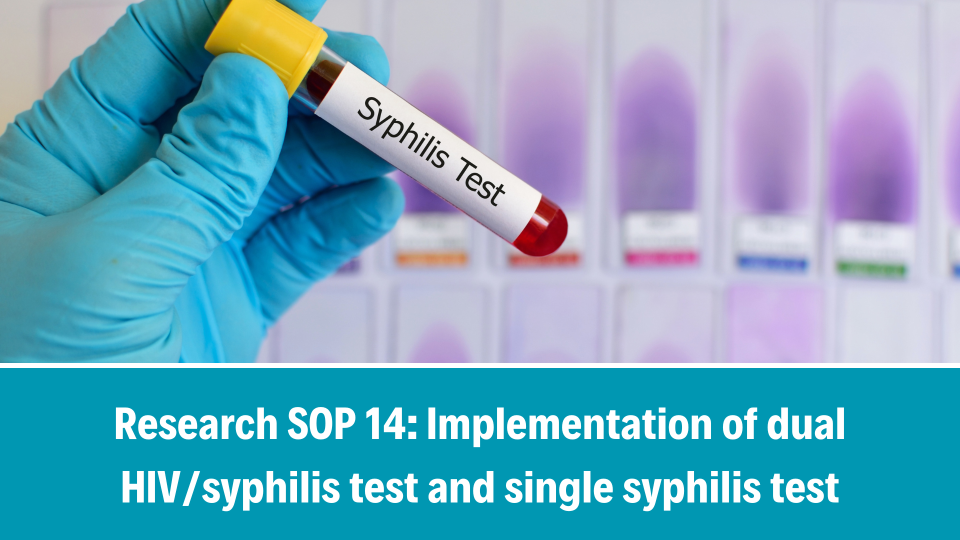 IS PrEP_R SOP 14: Implementation of dual HIV/syphilis test and single syphilis test, V1.0, 08 April 2024